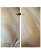 ココリ(CoCoRe)/背中wax