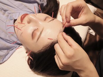 いいとこ鍼灸院/施術：美容鍼