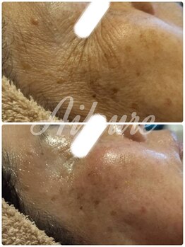 エルール トータルビューティ(Aileure total beauty)/Waxフェイシャル