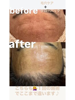 エムエー(MA)/ブラックピール