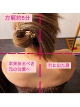 サロン ド レーヴ(Salon de Reve)/【お客様の事例】Billy’s Care