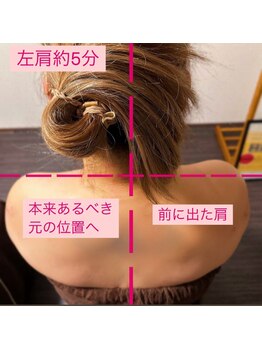 サロン ド レーヴ(Salon de Reve)/【お客様の事例】Billy’s Care