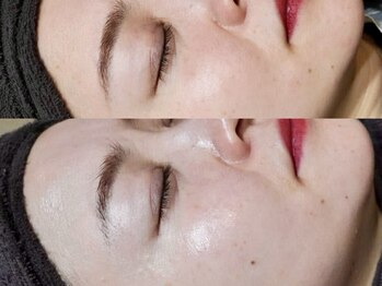 アオ 渋谷(ao.)/ララピール