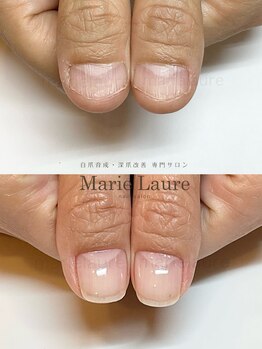 マリーロール 梅田店(Marie Laure)/深爪改善/自爪育成/ネイルケア