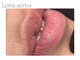 ロッタ エクリュ(Lotta ecru+)の写真/《リップ/バスト/デリケートゾーン/脇の黒ずみ》はこれからの時代悩まずに済みます◎