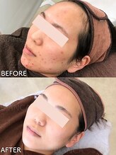 ビアンカ/お客様のお声