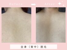 シエスタビューティラボの雰囲気（NOストレス脱毛。初回6,6000円で！見えない背中もキレイに脱毛。）