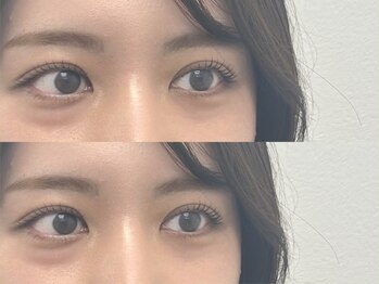 ピークアイ(Peek eye)/まつ毛パーマ