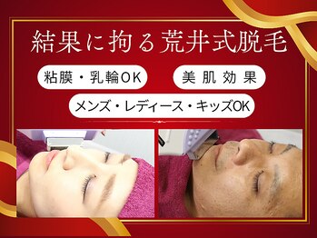 美容脱毛専門サロン エピラージュ 新宿店(Epilage)