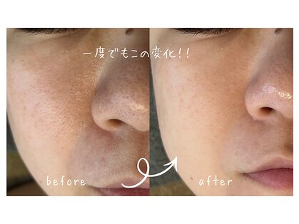 サロン リノ(salon rino)の写真