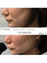 すずき接骨院/ホワイトスノーピール