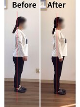 リライフ/Before/After