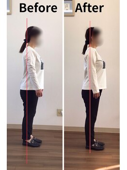 リライフ/Before/After