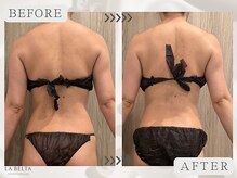 エステティックサロン ラ ベルタ(Esthetic Salon La Belta)/美骨ケア+セルライトゼロ