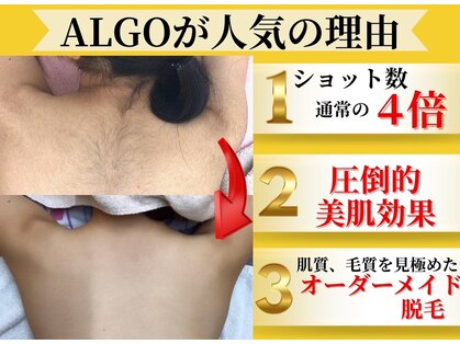 アルゴ 山口店(ALGO)の写真