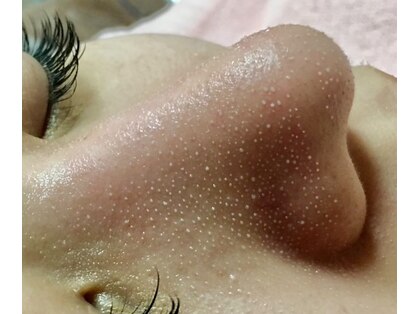 グレイス(Grace)の写真