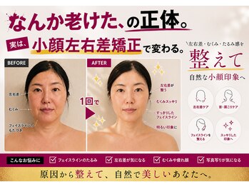 モアフェイス 池袋店(More Face)の写真/◆劇的アフター効果に自信あり◆オールハンド【頬骨フェイスライン矯正/リンパ矯正/首肩矯正】60分3980円～