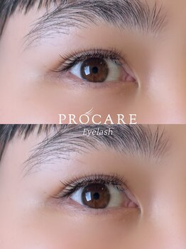 プロケア 新宿本店(PROCARE)/ボリュームラッシュ100束