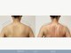 エパニ(epani)の写真/    肩・首のつらさと、もっこり肩が気になる方へ。軽やかに、すっきりした後ろ姿へ