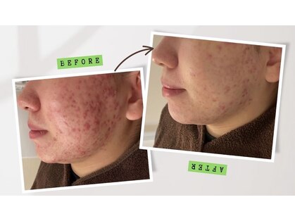 ノイ(noi.)の写真