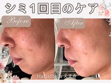 マリスステラ 天王寺(MarisStella)/1回の変化！！