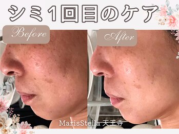 マリスステラ 天王寺(MarisStella)/1回の変化！！