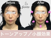 ゲントツ 参宮橋店(gentotsu)の雰囲気（10年先も自然の美しさ自分史上１番の小顔へ/小顔矯正/姿勢矯正）