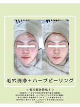 ソワナ(soina)/【神楽坂駅/フェイシャル/毛穴】