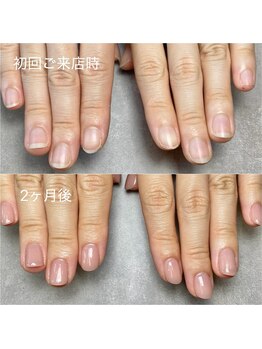 セン(SEN)/自爪育成