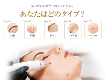 オービーエム 博多阪急店(O.B.M)/シミタイプ