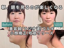 カンワ美容鍼灸院(KANWA美容鍼灸院)