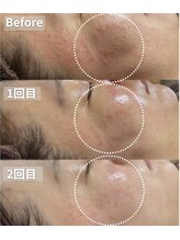 アイビーケア 三田(ivy care)&nbsp;肌管理フェ イシャル