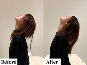 ソレア(Solea)/首こり改善1回目