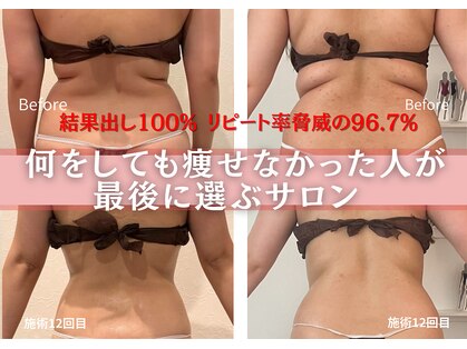 ハナ チュチュ(Hana chuchu)の写真