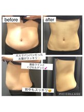 ベルスティン 中村橋本店(Belstin)/見た目も中身もアプローチ♪