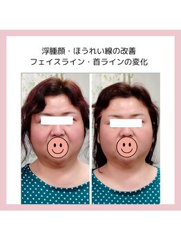 目元 口元のたるみ 眉間シワ改善専門サロン/体が浮腫む、代謝が悪い方向け