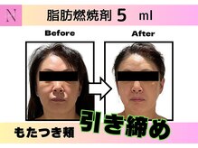 ナチュリ センター南院(NACHUL)/【小顔】‐3Kg見えの小顔造顔★