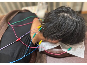 円山よもぎ鍼灸整骨院/鍼灸【不眠＊頭痛＊肩こり】