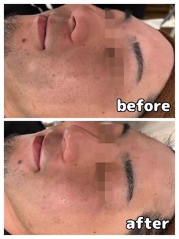 アモ(amo)/お肌の土台作りから!