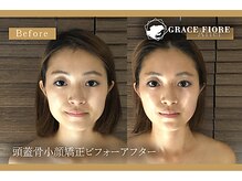 グレースフィオーレ 吉祥寺店(gracefiore)の雰囲気（頭皮から引き上げるテクニックで効果実感！眠れる小顔矯正☆）