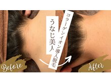 チャンティック(Cantik)/うなじケア