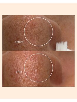 レア(Lea)/旅行前にお肌を綺麗に♪