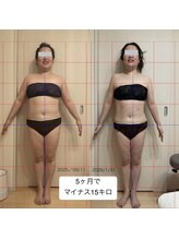 リリィ(lily)/5ヶ月でマイナス15キロ