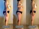 インディバベルフェム(INDIBA Belle Femme)の写真