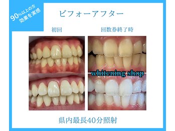 ホワイトニングショップ 太田店