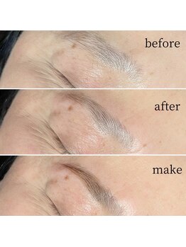 ヴィータ(VITA)/ハリウッドブロウリフト