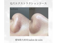 サロン ド ソワン(salon de soin)