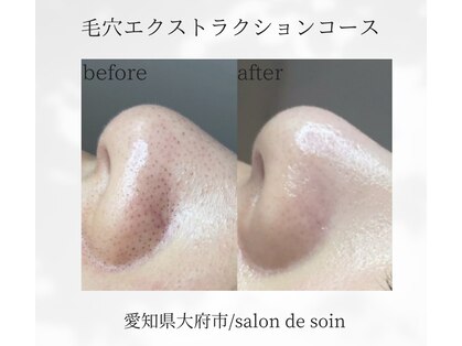 サロン ド ソワン(salon de soin)の写真