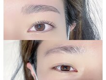 ホワイトテラス(White Terrace)/ハリウッドブロウリフト