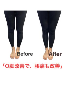 アサバ整体院 八潮店(ASABA整体院)/骨盤矯正で腰痛改善★結果写真